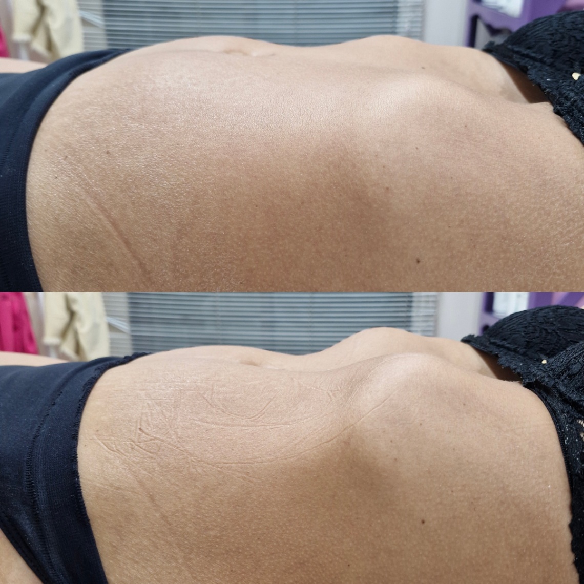 Trabalho de Esteticista por valeria braga Va em Vila Hermínia, São Paulo — foto 8 de 8