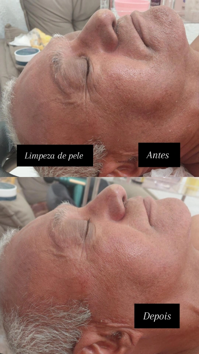 Trabalho de Massoterapeuta por Josefa Damiana dos Santos Mendes em Jardim Ponte Alta I, Guarulhos — foto 1 de 6