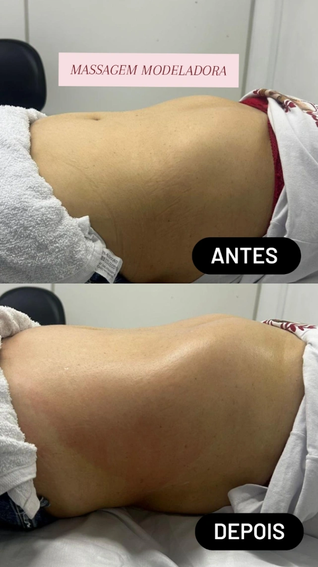 Trabalho de Massoterapeuta por Josefa Damiana dos Santos Mendes em Jardim Ponte Alta I, Guarulhos — foto 2 de 6