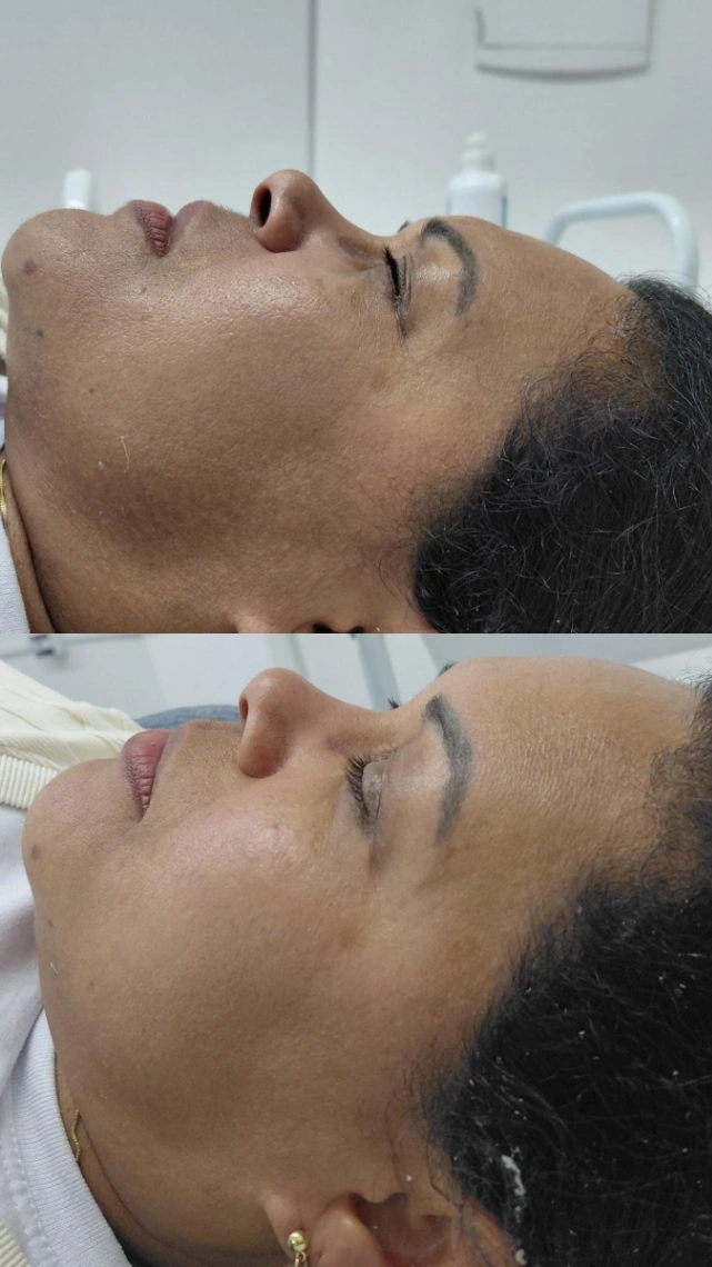 Trabalho de Massoterapeuta por Josefa Damiana dos Santos Mendes em Jardim Ponte Alta I, Guarulhos — foto 3 de 6