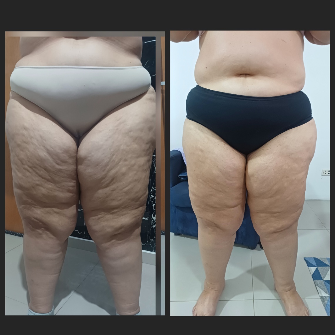 Trabalho de Massoterapeuta por Aline Esmiol em Taboão, Diadema — foto 1 de 3