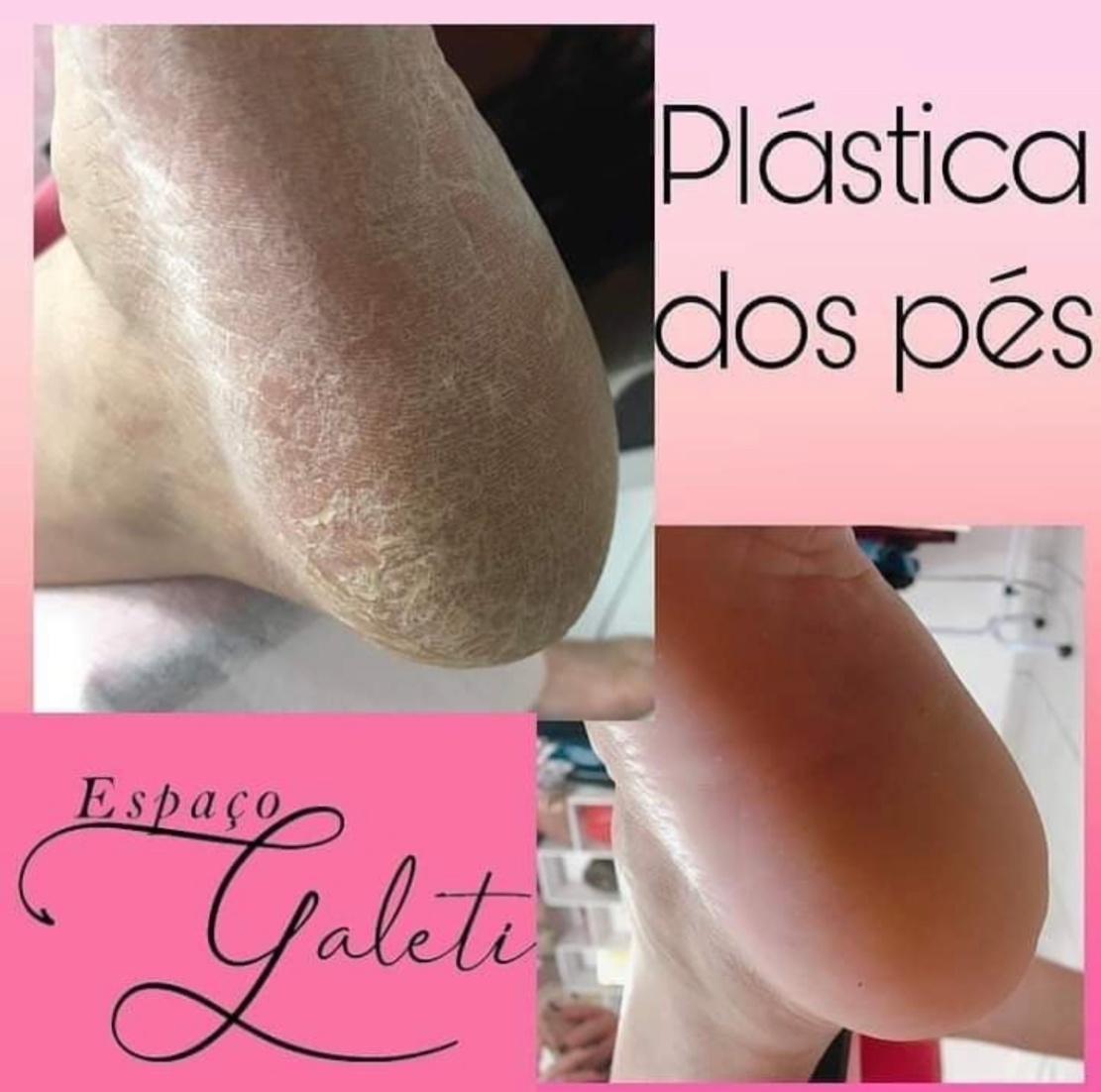 Trabalho de Nail Designer por Renata Galeti em Parque São Rafael, São Paulo — foto 29 de 46