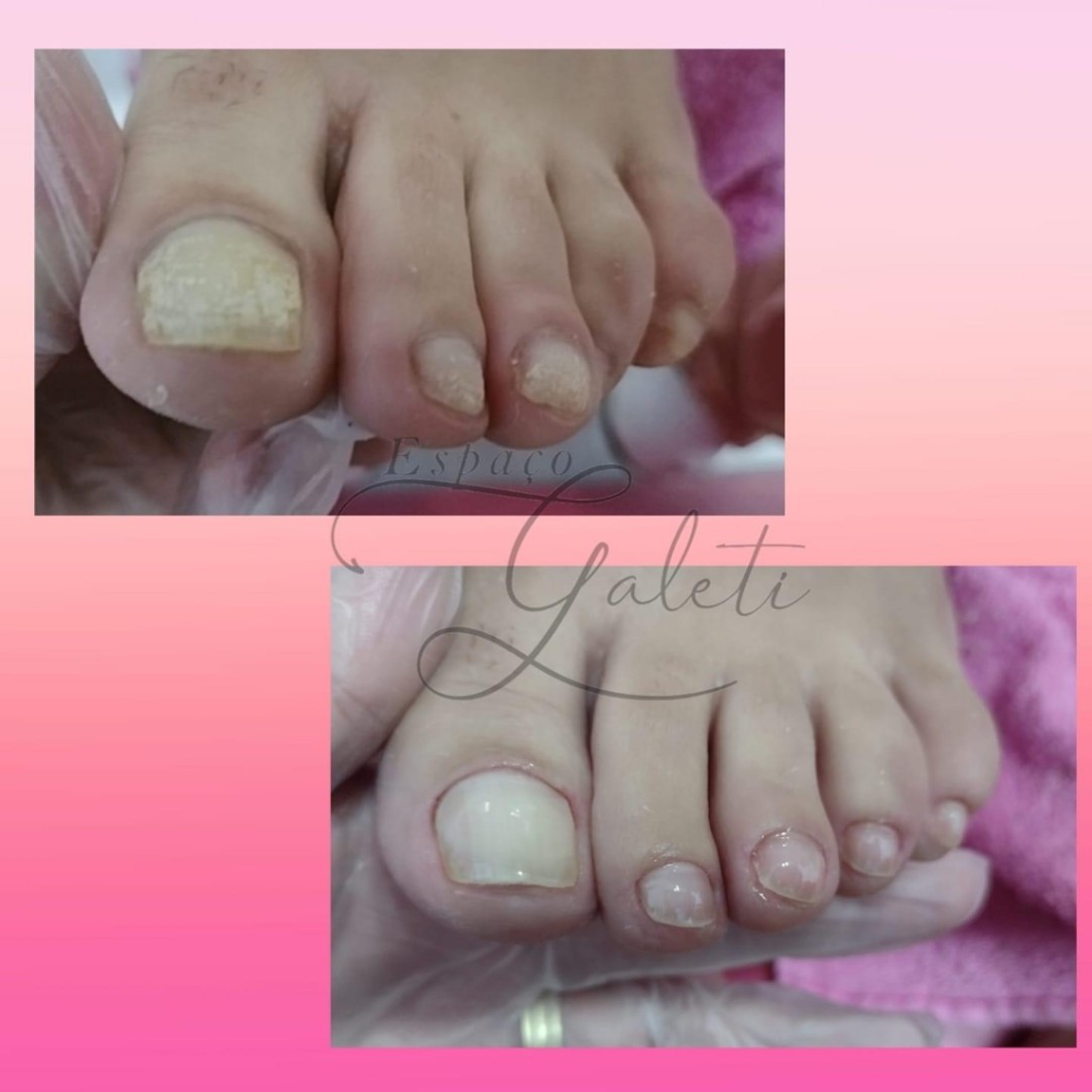 Trabalho de Nail Designer por Renata Galeti em Parque São Rafael, São Paulo — foto 38 de 46